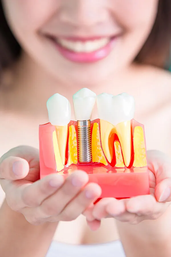 Single Implant