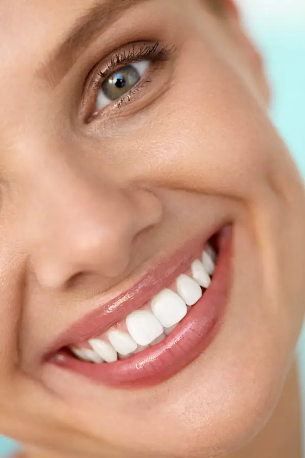 Smile Makeover