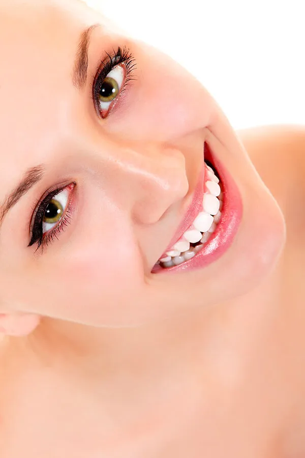 Veneers